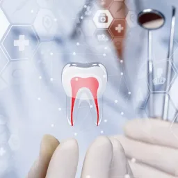 Fluoride penguat email gigi Versident