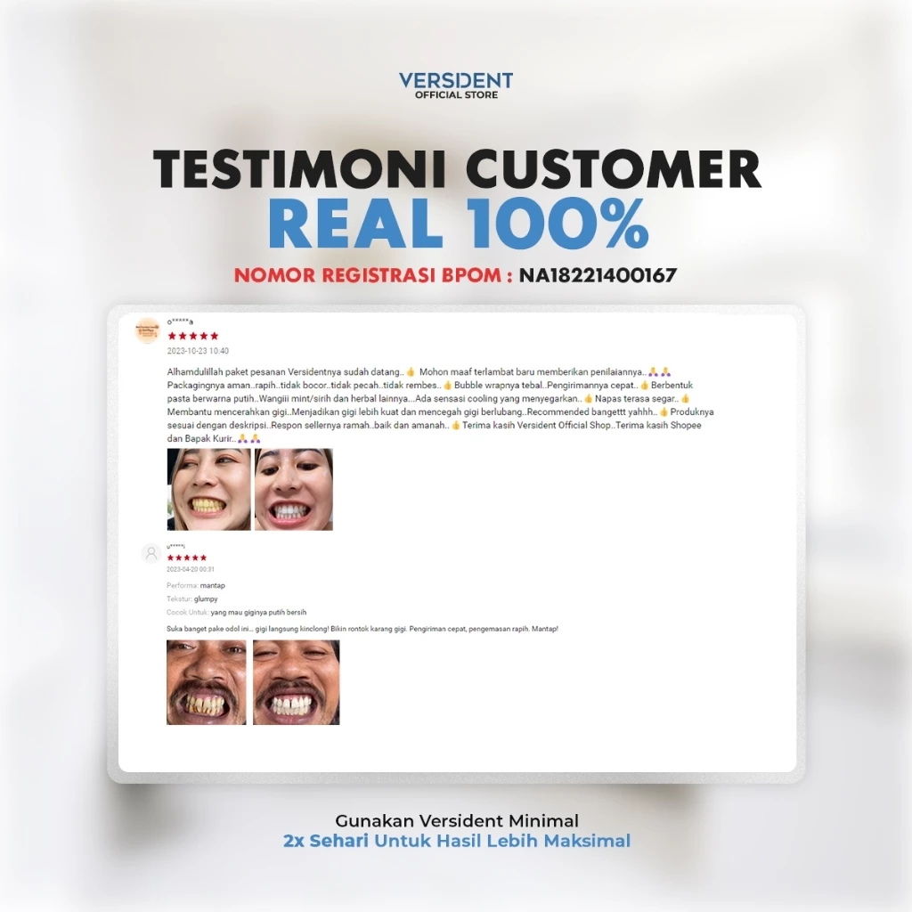 Testimoni customer Versident real 100%